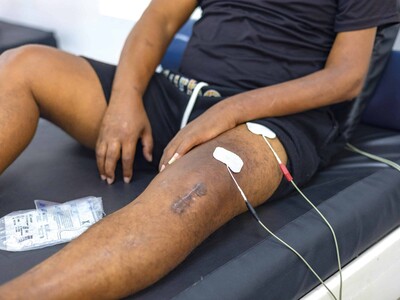 Rehabilitación tras accidentes en moto: el costo invisible