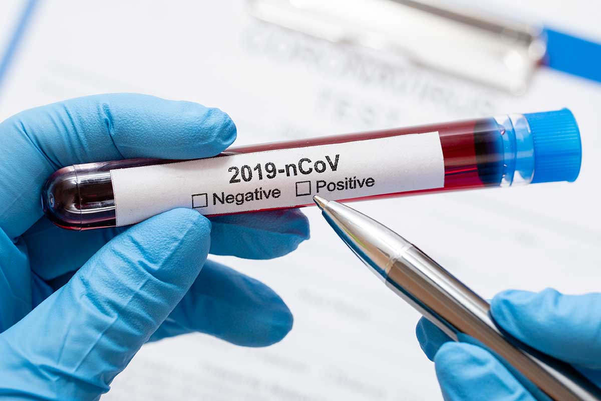 Más de tres mil muestras fueron analizadas. Foto: BioTech Magazine